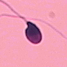 Amorphous