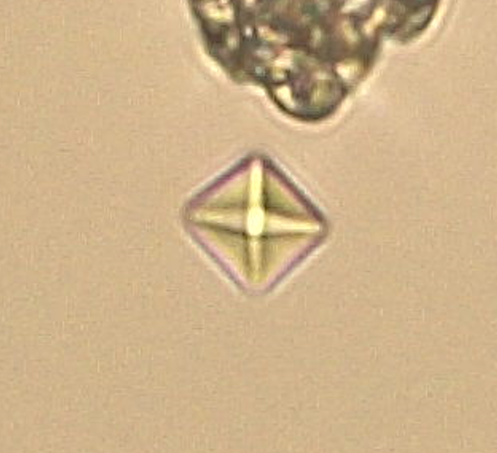 Urine Crystals