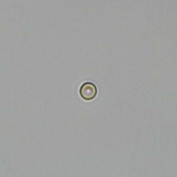 Urine Rbc